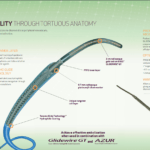 Terumo Progreat Catheter distributors in India