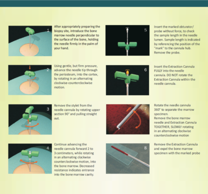 T-Handle Bone Marrow Biopsy Needles