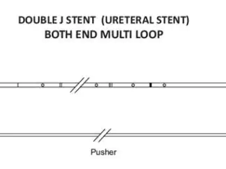 Ureteral double j stent multi loop india