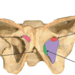 TOT needle set usage