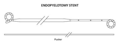 Endopyelotomy Stents in india